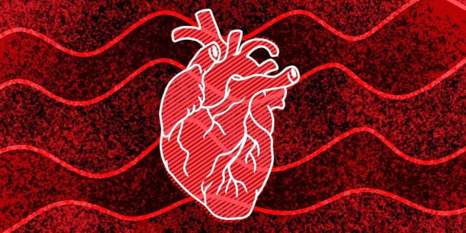 11 tegn på, at du kan ske hjertestop