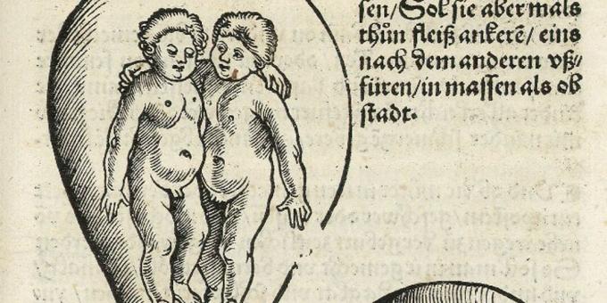 Børn i middelalderen: Tvillinger i livmoderen, Eucharius Rodion