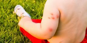 Hvad skal du gøre, hvis du er allergisk over for myggestik
