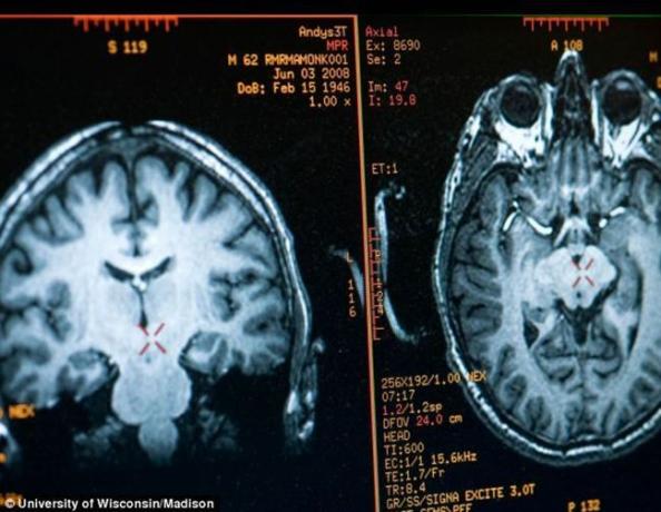 hjerne Mathieu Ricard billede opnået ved MRI