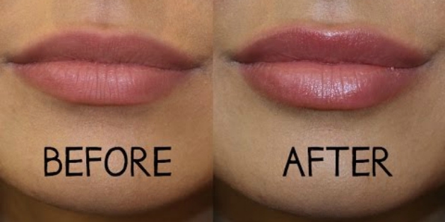spare på kosmetik: læbeforstørrelse
