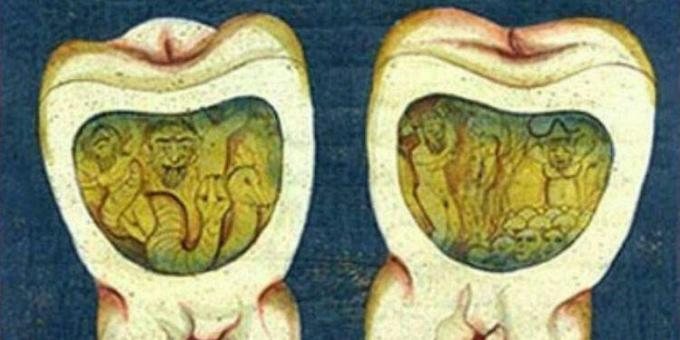 Middelaldermedicin: En side fra osmannisk tandbehandling, 1600 -tallet.